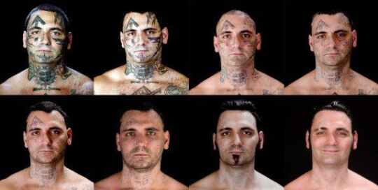 Quitar tatuaje con laser para olvidar un oscuro pasado 1