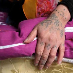 Cambio de color en los tatuajes de tinta negra a verde